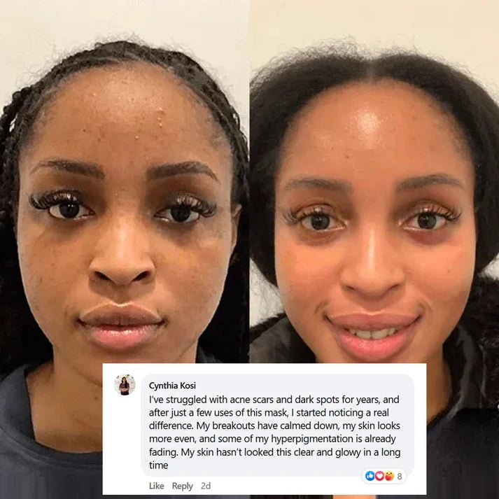 Mascarilla facial de colágeno con efecto lifting