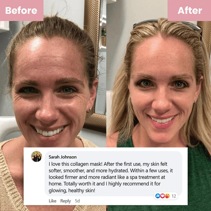 Mascarilla facial de colágeno con efecto lifting
