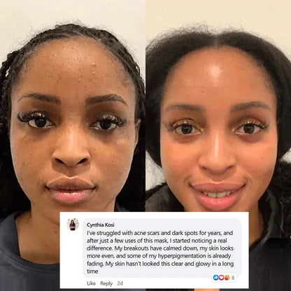 Mascarilla facial de colágeno con efecto lifting